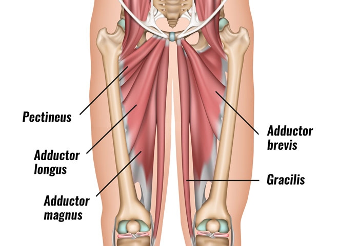 A groin strain is caused by overstretching or tearing the muscles in the groin area.